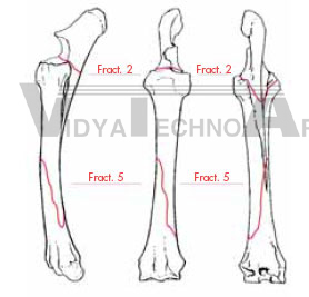 Equine Radius/Ulna, fractured Fracture set 1